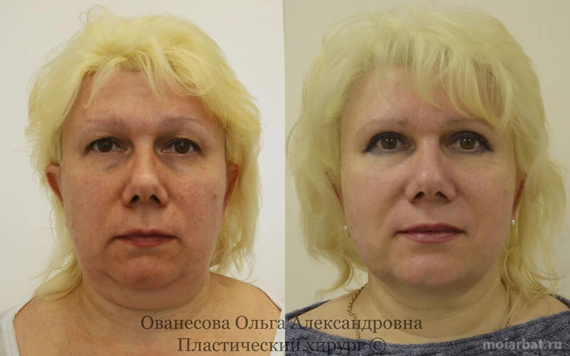 Центр пластической хирургии Dr.Ovanesova Изображение 18