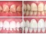 Стоматологическая клиника Smolensky Dental Clinic Изображение 7